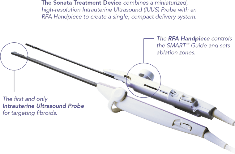 The Sonata® System - Gynesonics (US)