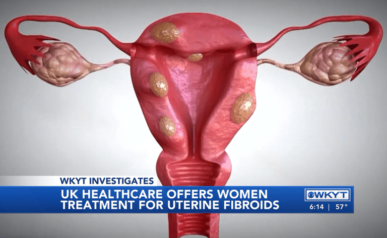 Healthcare'S Hidden Bias: Fibroids & Black Women (Instagram Live) - 4wnkwnd